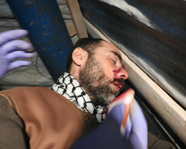 بالصور .. إصابة عدد من المدنيين في بلدة الفوعة المحاصرة بريف إدلب الشمالي 