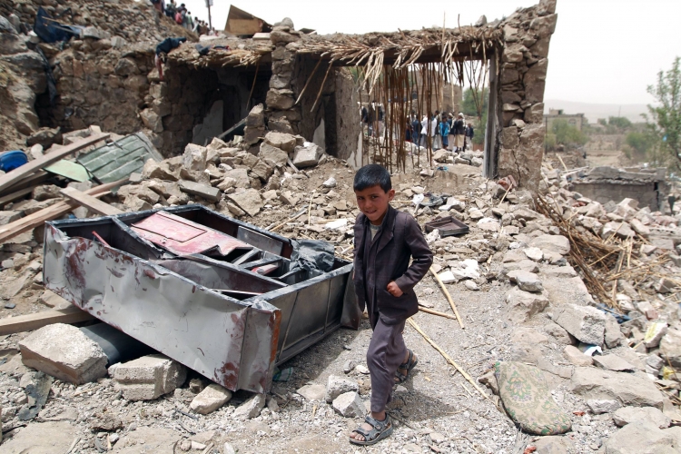 اصابة 9 نساء وأطفال يمنيين بغارات الطيران السعودي على باليمن