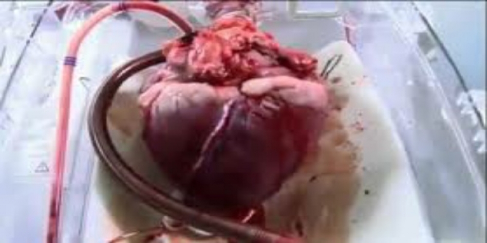 صناعة قلب بشري من أنسجة الفئران