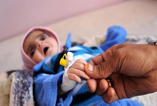 الصحة العالمية: ارتفاع ضحايا الكوليرا باليمن إلى 2180 حالة وفاة