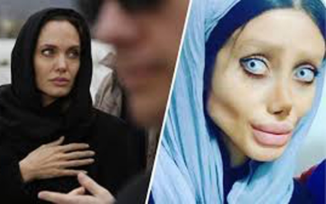 إيرانية تجري 50 عملية تجميل لتشبه أنجيلينا جولي ..و لكن !!