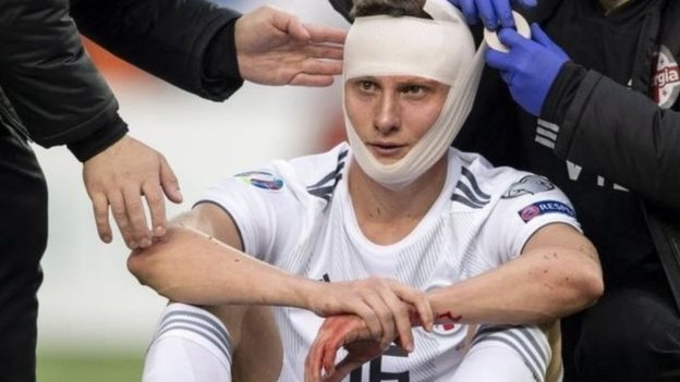 لاعب ينقذ حياة منافسه في مباراة بتصفيات أمم أوروبا2020