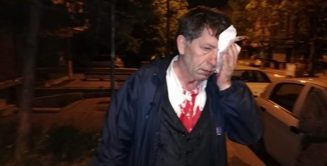 اعتداء على صحفي تركي معارض لأردوغان أمام منزله   