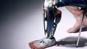 روسيا .. ابتكار أرجل اصطناعية مرتبطة بشبكة عصبية
