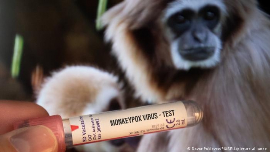 السلطات الصحية الامريكية: 21 إصابة بجدري القردة في البلاد