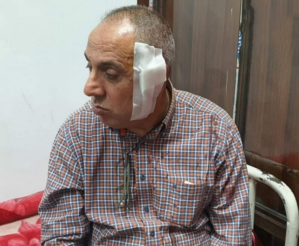 جامعة الفرات تصدر بيان فيما يخص الإعتداء بالضرب على عميد كلية الهندسة الزراعية