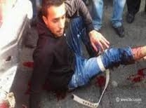 خاص جهينة نيوز: إطلاق النار على أرجل عمال جبل محسن وبيان 