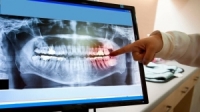 بيلاروسيا تطور لقاح مضاد لتسوس الأسنان