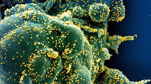 منظمة الصحة تعلن تسجيل ارتفاع قياسي جديد للإصابات بفيروس كورونا في العالم   