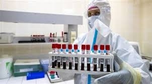 20 دولة تحجز مليار جرعة من اللقاح الروسي ضد كورونا   