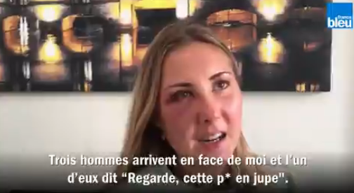 فرنسا... الاعتداء على شابة بسبب تنورتها