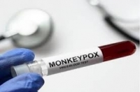 عالم مناعة روسي يحدد من يحتاج إلى التطعيم ضد جدري القردة