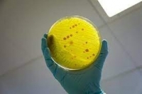 علماء صينيون يكتشفون مادة نانوية يمكنها قتل الميكروبات اللاهوائية